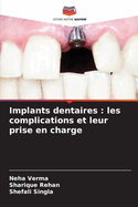 Implants dentaires: les complications et leur prise en charge