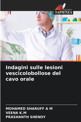 Indagini sulle lesioni vescicolobollose del cavo orale - Sharuff, Mohamed, and K M, Veena, and Shenoy, Prashanth