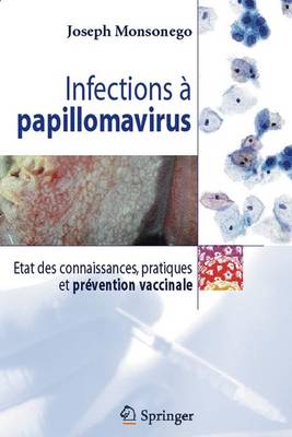 Infections a Papillomavirus: Etat Des Connaissances, Pratiques Et Prevention Vaccinale - Monsonego, Joseph