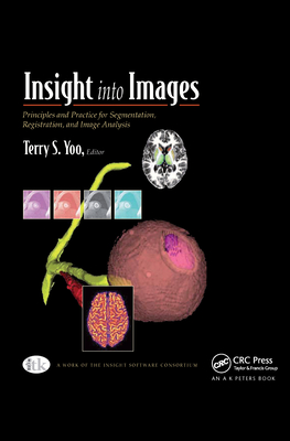 Insight into Images: Principles and Practice for Segmentation, Registration, and Image Analysis - Yoo, Terry S (Editor)