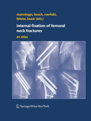 Internal Fixation of Femoral Neck Fractures: An Atlas - Manninger, Jen (Editor), and Bosch, Ulrich (Editor), and Cserhti, Peter (Editor)