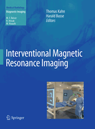 Interventional Magnetic Resonance Imaging