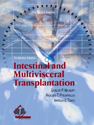 Intestinal and Multivisceral Transplantation - Molmenti, Ernesto P.