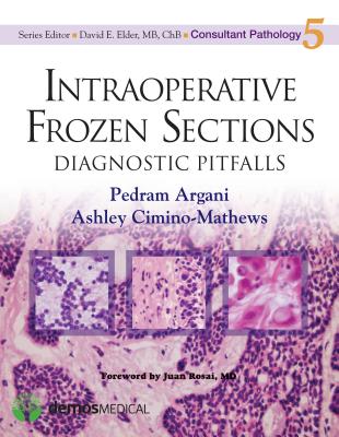 Intraoperative Frozen Sections: Diagnostic Pitfalls - Argani, Pedram, and Cimino-Mathews, Ashley