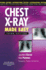 Chest X-Ray Made Easy Third Edition