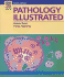 Pathology Illustrated