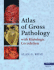 Atlas of Gross Pathology: With Histologic Correlation