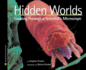 Hidden Worlds: Looking Through a Scientist's Microscope (Turtleback School & Library Binding Edition)