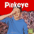 Pinkeye