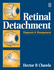 Retinal Detachment: the Essentials of Management