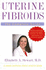 Uterine Fibroids: the Complete Guide