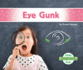 Eye Gunk (Beginning Science: Gross Body Functions)