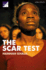 The Scar Test Modern Plays