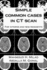 Simple common cases in CT scan: For interns and new residents