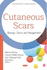 Cutaneous Scars Biology, Clinics and Management Biology, Clinics and Management