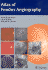 Atlas of Fundus Angiography