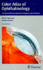 Color Atlas of Ophthalmology: The Quick-Reference Manual for Diagnosis and Treatment