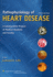 Pathophysiology of Heart Disease: a Collaborative Project of Medical Students and Faculty
