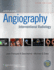 Abrams' Angiography: Interventional Radiology