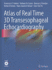 Atlas of Real Time 3d Transesophageal Echocardiography