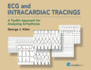 Ecg and Intracardiac Tracings: a Toolkit Approach for Analyzing Arrhythmias