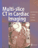 Multi-Slice Ct in Cardiac Imaging