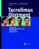 Tacrolimus