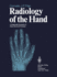 Radiology of the Hand: A Diagnostic Synopsis of Many General Diseases