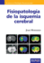 Fisiopatologa de la isquemia cerebral