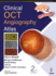 Clinical OCT Angiography Atlas