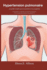 Hypertension pulmonaire: un guide complet pour les patients et les soignants: Comprendre les symptmes, les options de traitement et les stratgies pour amliorer la qualit de vie