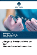 J?ngste Fortschritte bei der Wurzelkanalobturation