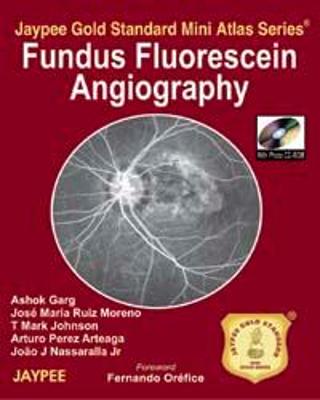 Jaypee Gold Standard Mini Atlas Series: Fundus Fluorescein Angiography - Garg, Ashok, and Moreno, Jose Maria Ruiz, and Johnson, T Mark