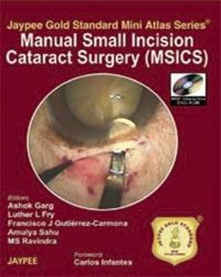 Jaypee Gold Standard Mini Atlas Series: Manual Small Incision Cataract Surgery (MSICS) - Garg, Ashok, and Fry, Luther L, and Sahu, Amulya