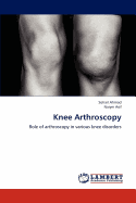 Knee Arthroscopy