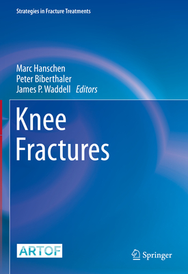 Knee Fractures - Hanschen, Marc (Editor), and Biberthaler, Peter (Editor), and Waddell, James P (Editor)