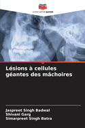 L?sions ? cellules g?antes des m?choires