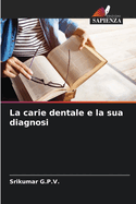 La carie dentale e la sua diagnosi