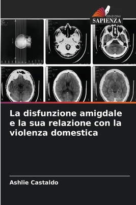 La disfunzione amigdale e la sua relazione con la violenza domestica - Castaldo, Ashlie