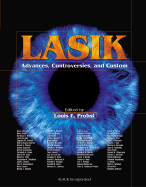 Lasik: Advances, Controversies, and Custom