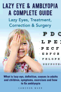 Lazy Eye & Amblyopia. Lazy Eyes, Treatment, Correction and Surgery. What Is Lazy Eye, Definition, Causes in Adults and Children, Symptoms, Exercises. a Complete Guide.