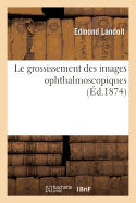 Le grossissement des images ophthalmoscopiques