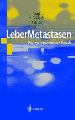 Lebermetastasen: Diagnose Intervention Therapie - Vogl, T J (Editor), and Mack, M G (Editor), and Balzer, J O (Editor)