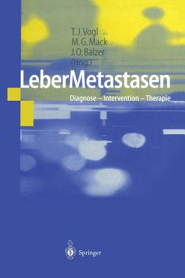 Lebermetastasen: Diagnose -- Intervention -- Therapie - Vogl, T J (Editor), and Mack, M G (Editor), and Balzer, J O (Editor)