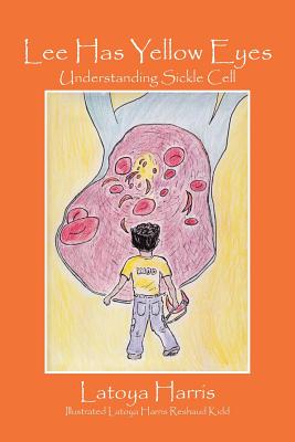 Lee Has Yellow Eyes: Understanding Sickle Cell - Harris, Latoya