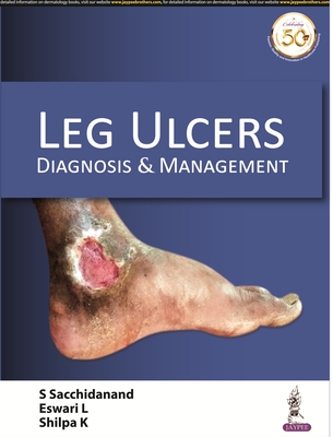 Leg Ulcers: Diagnosis & Management - Sacchidanand, S, and L, Eswari, and K, Shilpa