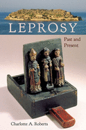 Leprosy: Past and Present
