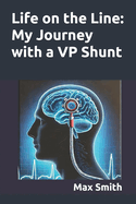 Life on the Line: My Journey with a VP Shunt