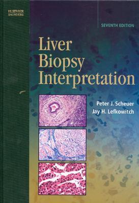 Liver Biopsy Interpretation - Lefkowitch, Jay H, MD, and Scheuer, Peter J, Dsc(med)