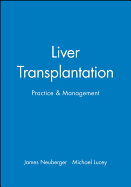 Liver Transplantation: Practice and Management
